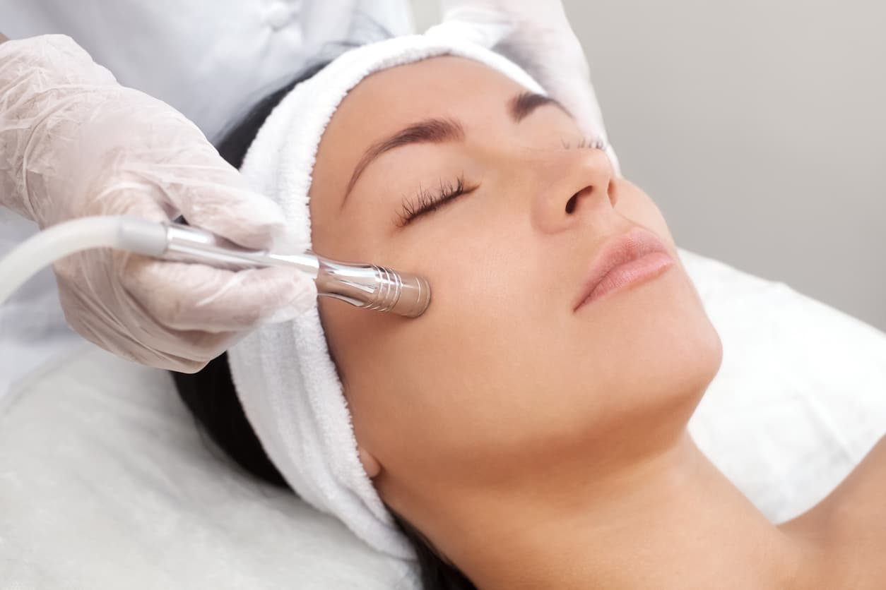 Peeling de Diamante